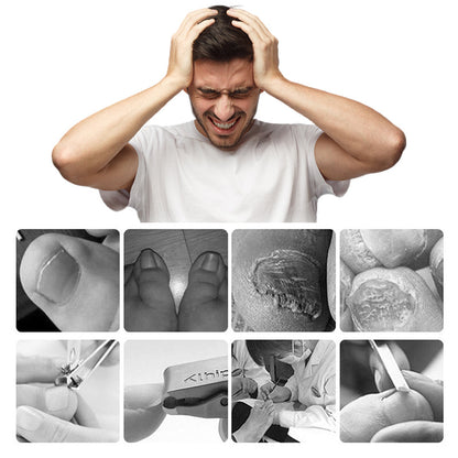 Professionell nagelklippare för inåtväxande tånaglar, 7 delar